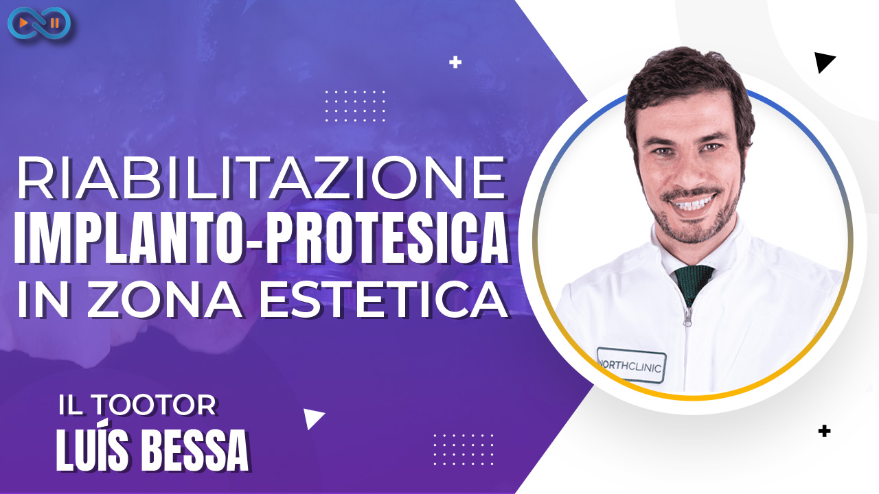 Ice_cream_cone_Bessa